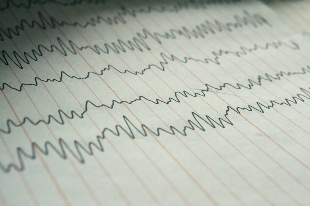 What Happens in a Sleep Study? Johns Hopkins HealthyWorks